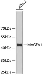 Anti-MAGE 1 antibody used in Western Blot (WB). GTX64672