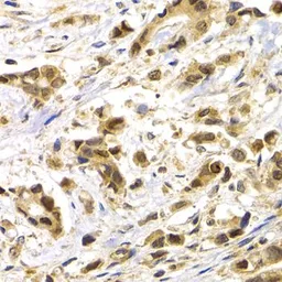 Anti-MAGE 1 antibody used in IHC (Paraffin sections) (IHC-P). GTX64672