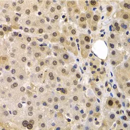 Anti-MAGE 1 antibody used in IHC (Paraffin sections) (IHC-P). GTX64672