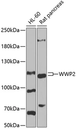 Anti-AIP2 antibody used in Western Blot (WB). GTX64673
