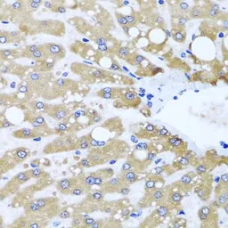 Anti-NDUFS3 antibody used in IHC (Paraffin sections) (IHC-P). GTX64675