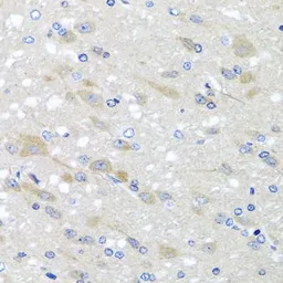Anti-NDUFS3 antibody used in IHC (Paraffin sections) (IHC-P). GTX64675