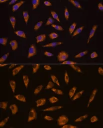 Anti-GLP1R antibody used in Immunocytochemistry/ Immunofluorescence (ICC/IF). GTX64676