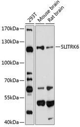 Anti-SLITRK6 antibody used in Western Blot (WB). GTX64677