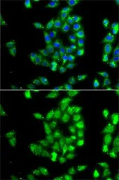 Anti-TEM8 antibody used in Immunocytochemistry/ Immunofluorescence (ICC/IF). GTX64680
