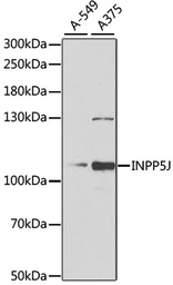 Anti-PIB5PA antibody used in Western Blot (WB). GTX64681