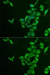 Anti-PIB5PA antibody used in Immunocytochemistry/ Immunofluorescence (ICC/IF). GTX64681
