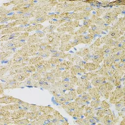Anti-PIB5PA antibody used in IHC (Paraffin sections) (IHC-P). GTX64681