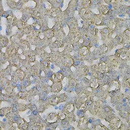 Anti-PIB5PA antibody used in IHC (Paraffin sections) (IHC-P). GTX64681