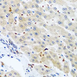 Anti-RGS5 antibody used in IHC (Paraffin sections) (IHC-P). GTX64682
