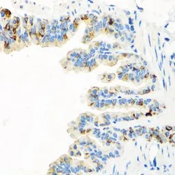 Anti-RGS5 antibody used in IHC (Paraffin sections) (IHC-P). GTX64682