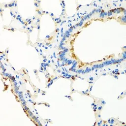 Anti-RGS5 antibody used in IHC (Paraffin sections) (IHC-P). GTX64682