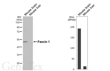 Anti-Fascin 1 antibody [HL5768] used in Western Blot (WB). GTX646839