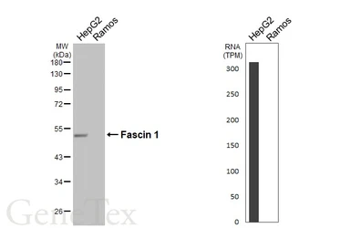 Anti-Fascin 1 antibody [HL5768] used in Western Blot (WB). GTX646839