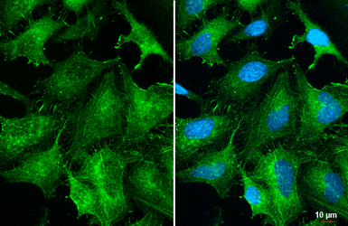 Anti-Fascin 1 antibody [HL5768] used in Immunocytochemistry/ Immunofluorescence (ICC/IF). GTX646839
