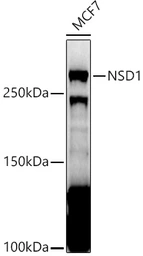 Anti-NSD1 antibody used in Western Blot (WB). GTX64684