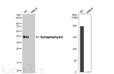 Anti-Synaptophysin antibody [HL5771] used in Western Blot (WB). GTX646842