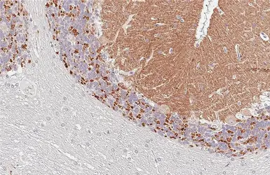 Anti-Synaptophysin antibody [HL5771] used in IHC (Paraffin sections) (IHC-P). GTX646842