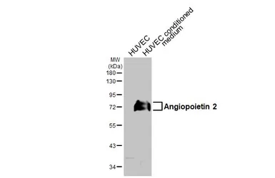 Anti-Angiopoietin 2 antibody [HL5774] used in Western Blot (WB). GTX646845