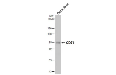 Anti-CD71 antibody [HL5775] used in Western Blot (WB). GTX646846