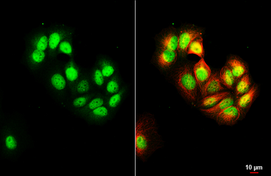 Anti-MGMT antibody [HL5777] used in Immunocytochemistry/ Immunofluorescence (ICC/IF). GTX646848