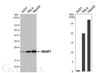 Anti-MGMT antibody [HL5777] used in Western Blot (WB). GTX646848