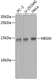 Anti-Neurogranin antibody used in Western Blot (WB). GTX64685