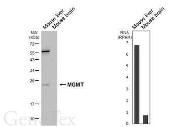 Anti-MGMT antibody [HL5779] used in Western Blot (WB). GTX646850
