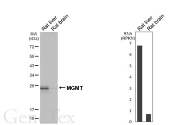 Anti-MGMT antibody [HL5779] used in Western Blot (WB). GTX646850