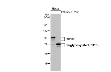 Anti-CD105 antibody [HL5785] used in Western Blot (WB). GTX646856