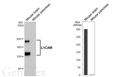 Anti-L1CAM antibody [HL5786] used in Western Blot (WB). GTX646857