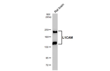Anti-L1CAM antibody [HL5786] used in Western Blot (WB). GTX646857
