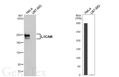 Anti-L1CAM antibody [HL5786] used in Western Blot (WB). GTX646857