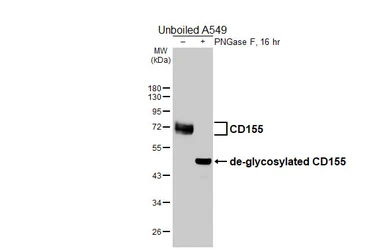 Anti-CD155 antibody [HL5788] used in Western Blot (WB). GTX646859
