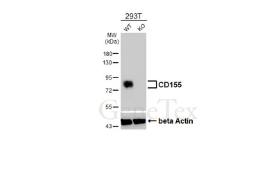 Anti-CD155 antibody [HL5788] used in Western Blot (WB). GTX646859