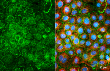 Anti-GPRC5B antibody [HL5794] used in Immunocytochemistry/ Immunofluorescence (ICC/IF). GTX646865