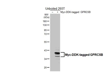 Anti-GPRC5B antibody [HL5794] used in Western Blot (WB). GTX646865