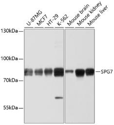 Anti-SPG7 antibody used in Western Blot (WB). GTX64687