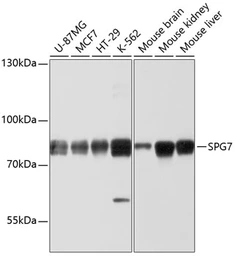 Anti-SPG7 antibody used in Western Blot (WB). GTX64687