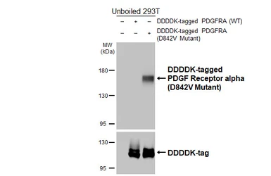 Anti-PDGF Receptor alpha (D842V Mutant) antibody [HL5800] used in Western Blot (WB). GTX646871