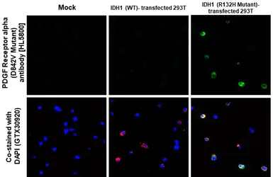 Anti-PDGF Receptor alpha (D842V Mutant) antibody [HL5800] used in IHC-P (cell pellet) (IHC-P (cell pellet)). GTX646871