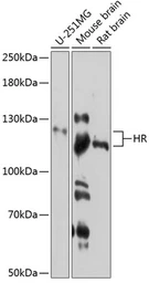Anti-Hairless antibody used in Western Blot (WB). GTX64693