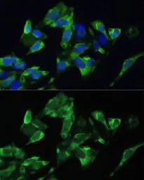 Anti-PMEPA1 antibody used in Immunocytochemistry/ Immunofluorescence (ICC/IF). GTX64694