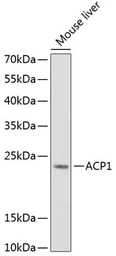 Anti-ACP1 antibody used in Western Blot (WB). GTX64697