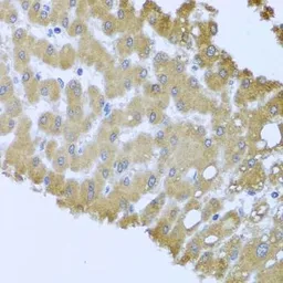 Anti-ACP1 antibody used in IHC (Paraffin sections) (IHC-P). GTX64697