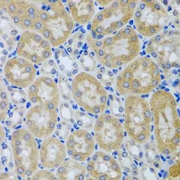 Anti-ACP1 antibody used in IHC (Paraffin sections) (IHC-P). GTX64697