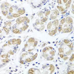 Anti-ACP1 antibody used in IHC (Paraffin sections) (IHC-P). GTX64698