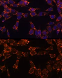 Anti-NCE2 antibody used in Immunocytochemistry/ Immunofluorescence (ICC/IF). GTX64701