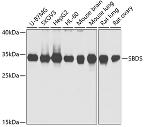 Anti-SBDS antibody used in Western Blot (WB). GTX64702