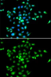 Anti-SBDS antibody used in Immunocytochemistry/ Immunofluorescence (ICC/IF). GTX64702